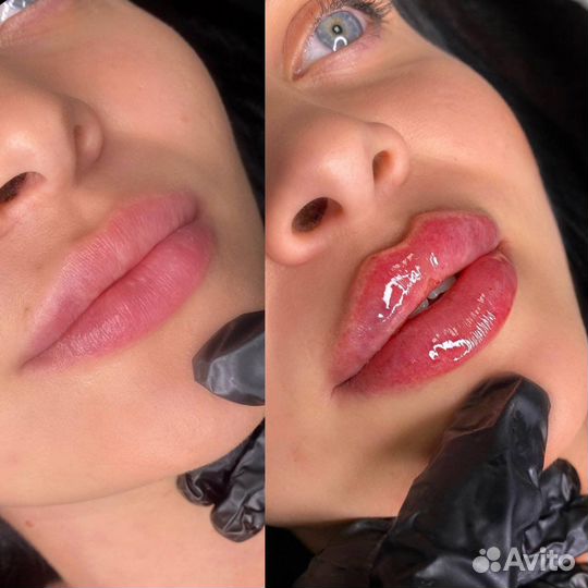 Обучение косметологов