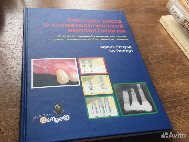 Факторы риска в стоматологической имплантологии Ф