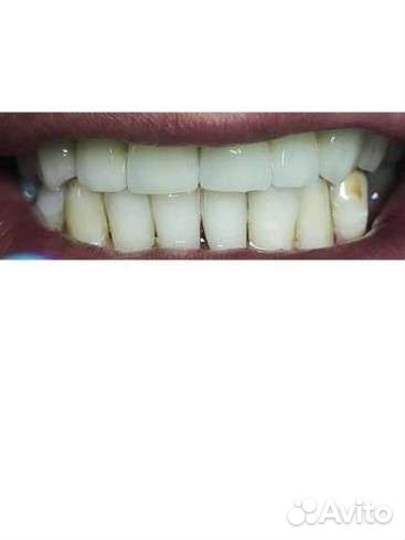 Зубной техник керамист