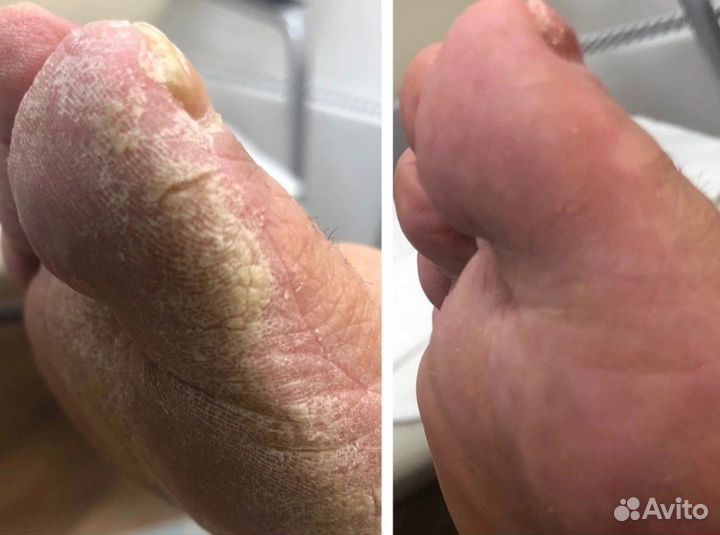 Маникюр педикюр