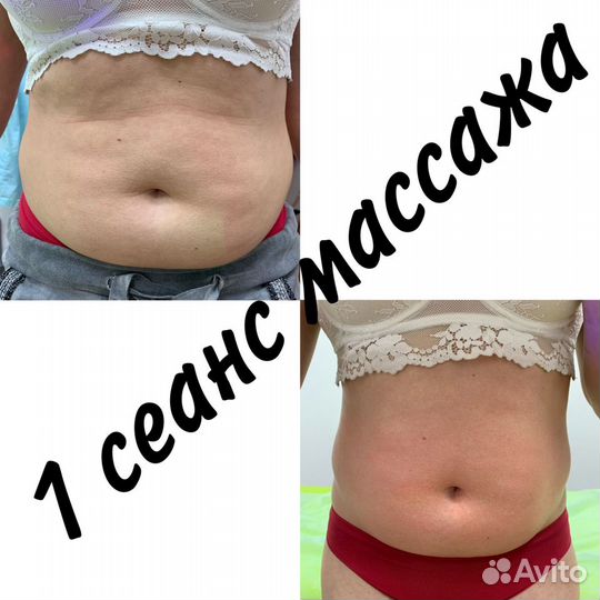 Массаж лечебный