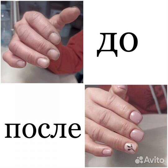 Наращивание ногтей