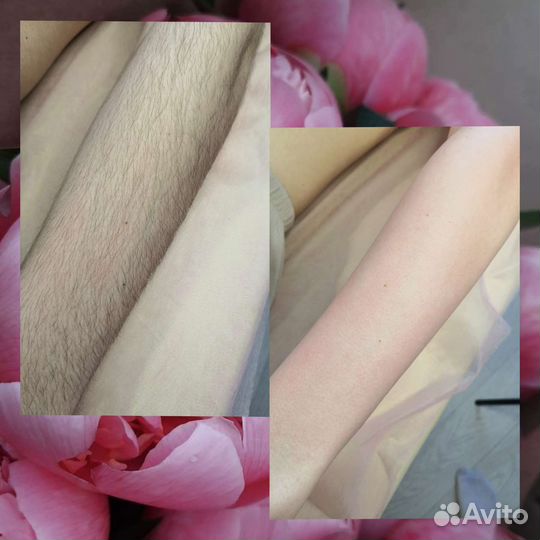 Шугаринг депиляция