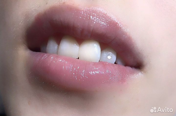 Установка скайсов