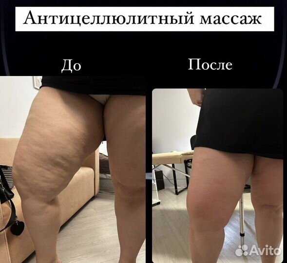 Медицинский массаж на дому