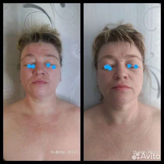 Массаж лица