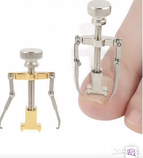 Корректор вросших негтей