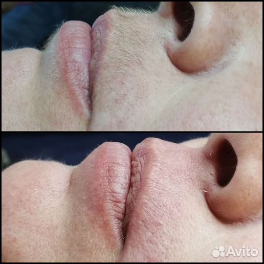 Шугаринг женский