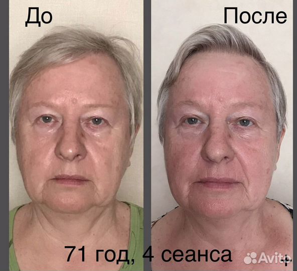 Детский массаж