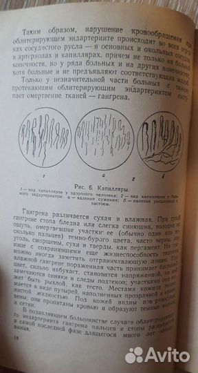 Медгиз 1957 год - книга о заболеваниях сосудов и к