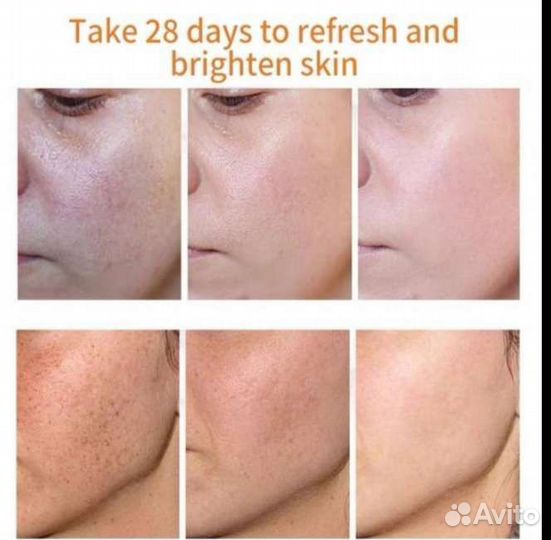 Отбеливающий крем