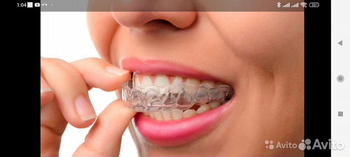 Ремонт изготовление зубные протезы, каппы