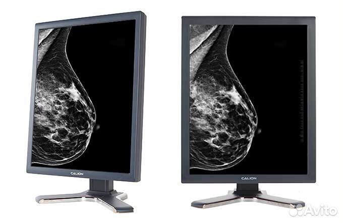 Монитор врача рентгенолога