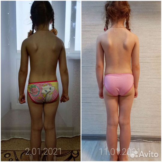 Детский массаж, логопедический массаж