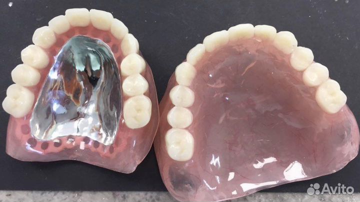 Починка протезов,ортодонтических аппаратов