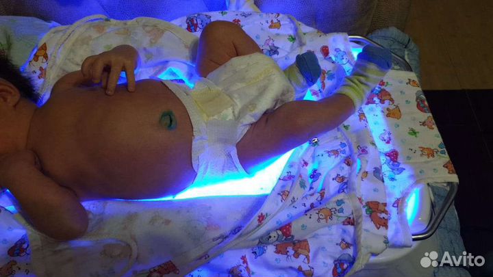 Лампа-гамак от желтухи, замер билирубина