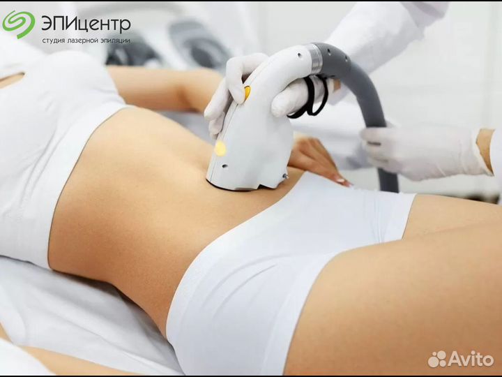 Лазерная эпиляция