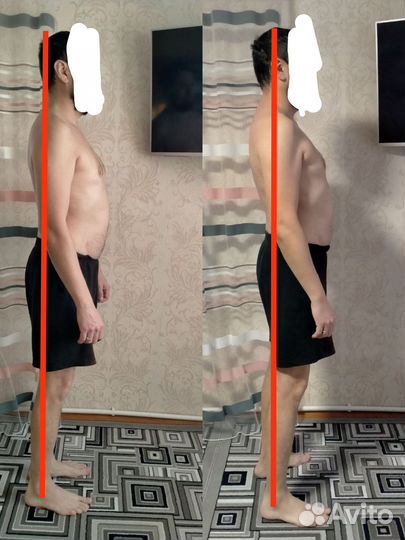 Лимфатический массаж