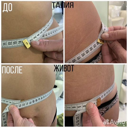 Антицеллюлитный массаж похудение