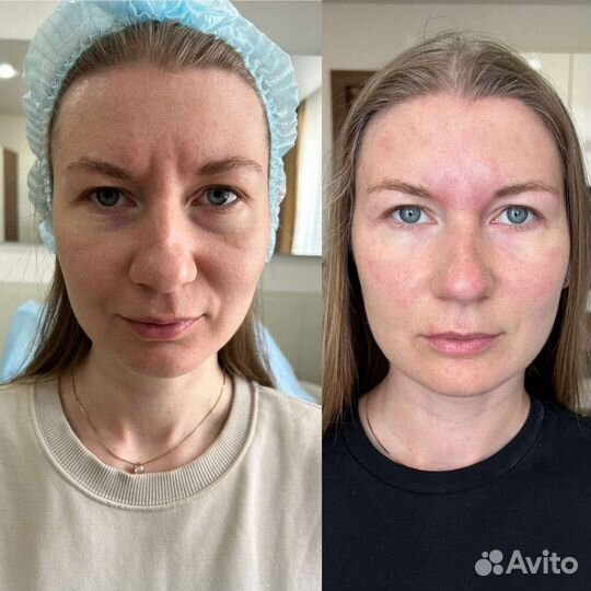 Врач-косметолог, 21 год опыт работы