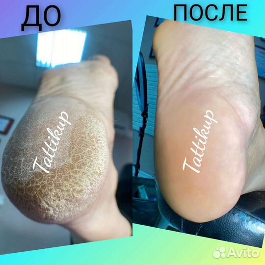 Маникюр и педикюр