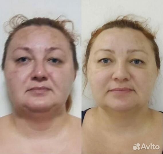 Массаж лица