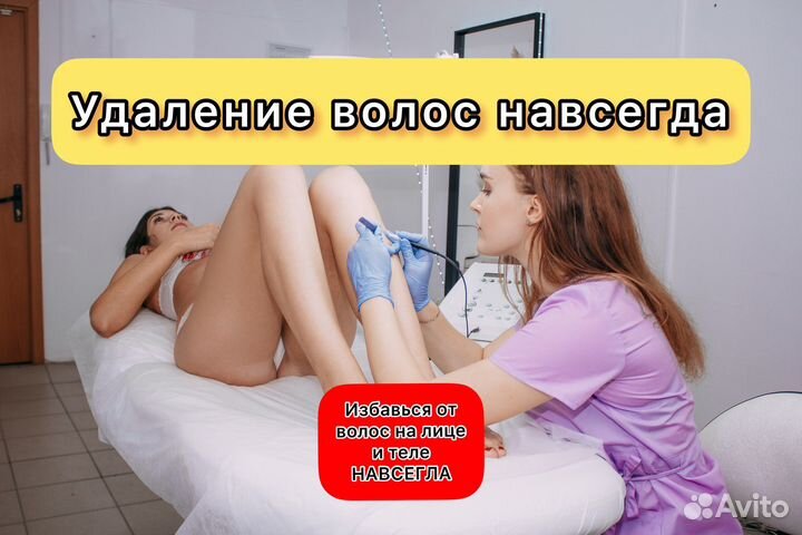 Электроэпиляция