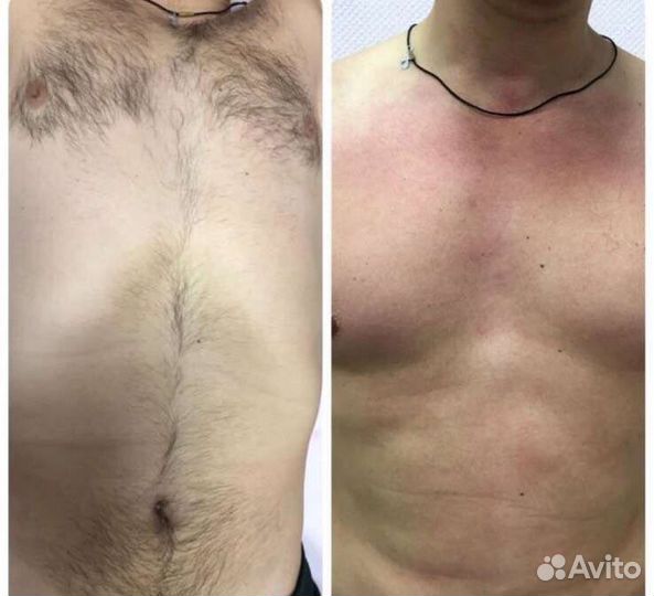 Мужская и женская депиляция воском и сахаром