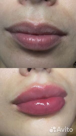 Модель на увеличение губ