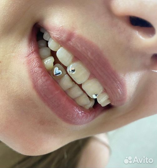 Скайсы/денттату/клыки