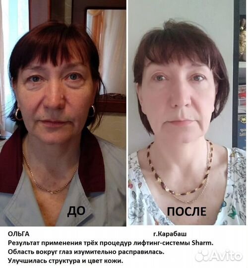 Косметика Hazna для тонуса мышц лица