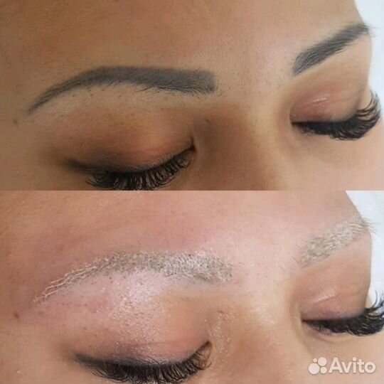 Удаление перманентного макияжа