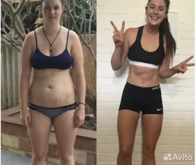 LPG массаж, Vela Shape, Кавитация