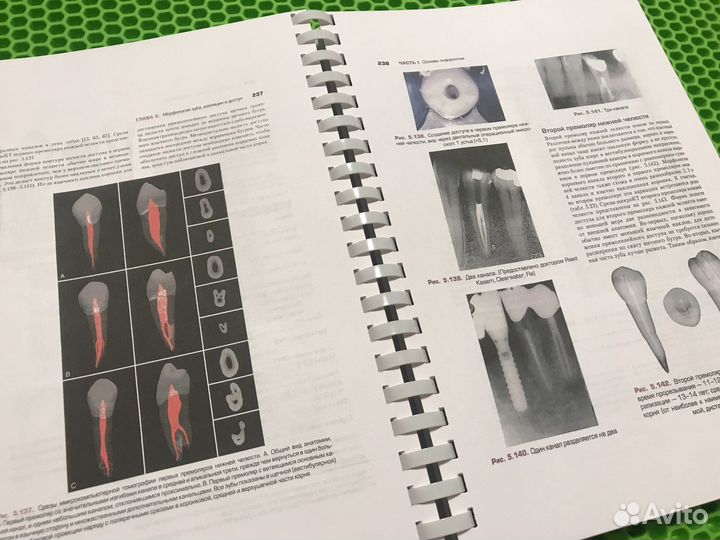 Эндодонтия С. Коэн