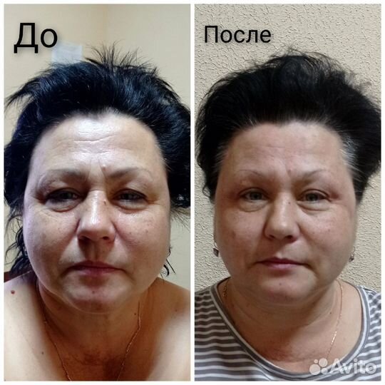 Массаж лица обучение