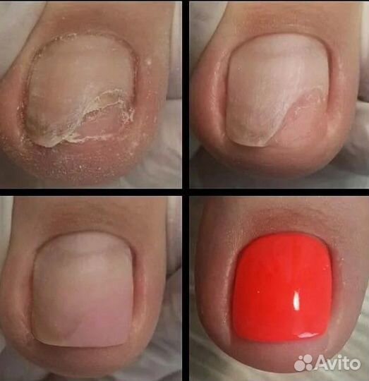 Педикюр Протезирование ногтей в салоне