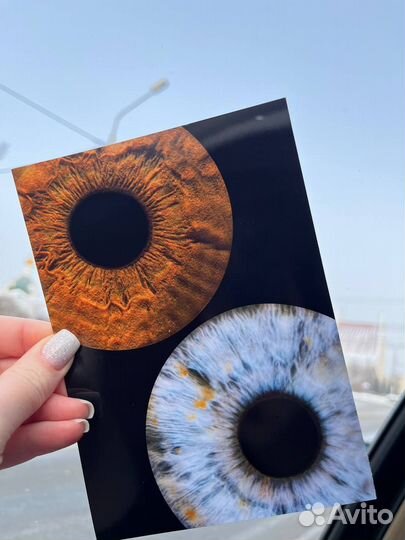 Фотография радужки глаза