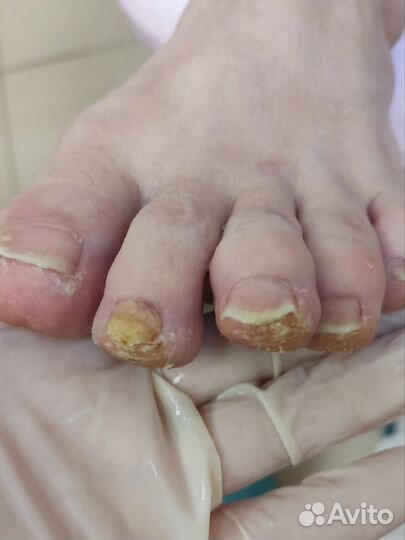 Специалист подолог,педикюр