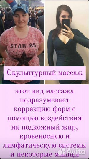 Коррекция фигуры/ скульптурный массаж