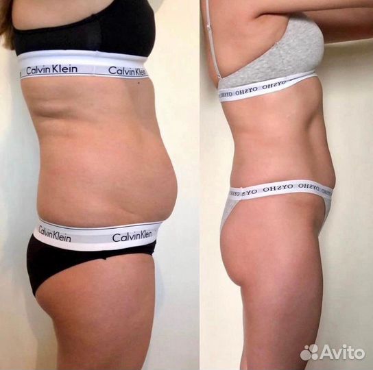 Коррекция фигуры, аппаратный массаж, ручной массаж