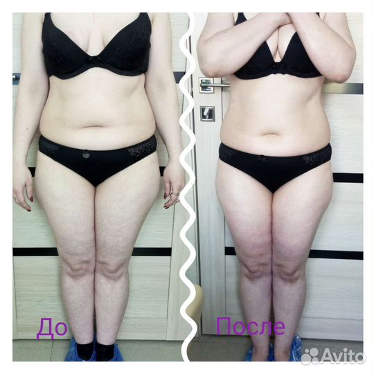 Аппаратный массаж