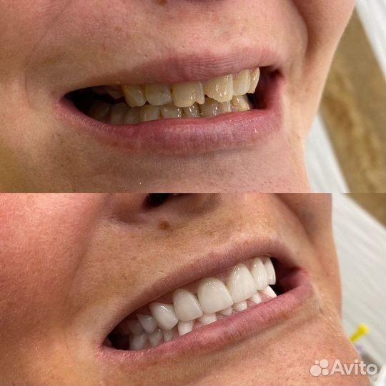 Зуботехнические услуги лаборатории