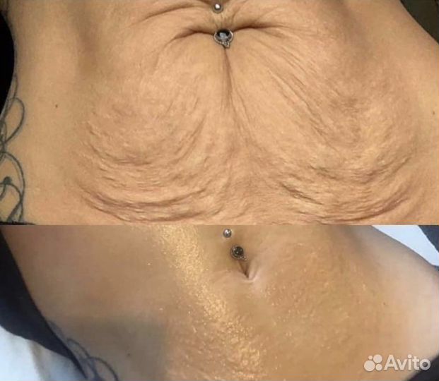 Жиросжигание Фито Гелем /Коррекция фигуры