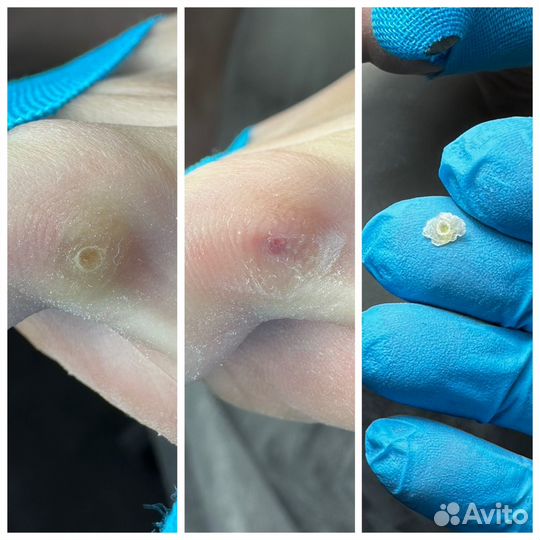 Услуги подолога