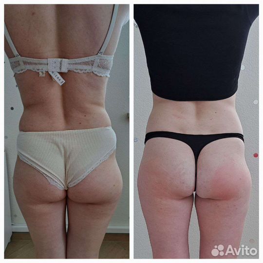 Сахарное моделирование