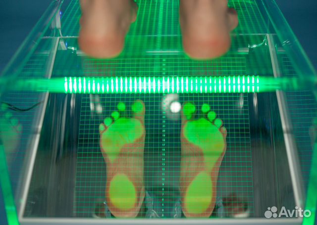 Коррекция плоскостопия. Ортопедические стельки