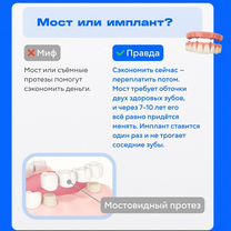 Полная имплантация челюсти На 40+ лет Рассрочка, Москва