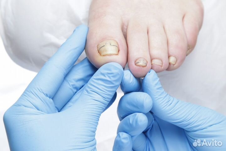 Услуги подолога