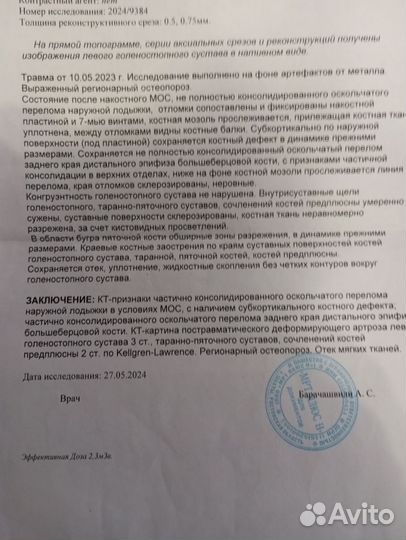 Продам фары лада гранда