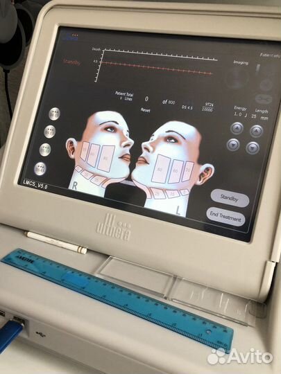 СМАС лифтинг Альтера